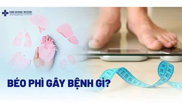 Béo phì gây ra những bệnh gì? Nguy cơ của béo phì bạn phải nhận biết ngay